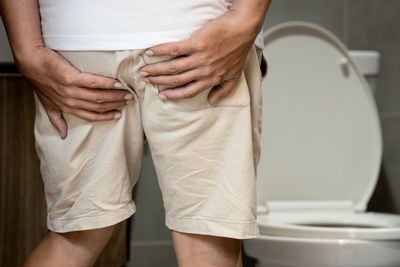 Illustration of Hemorrhoids